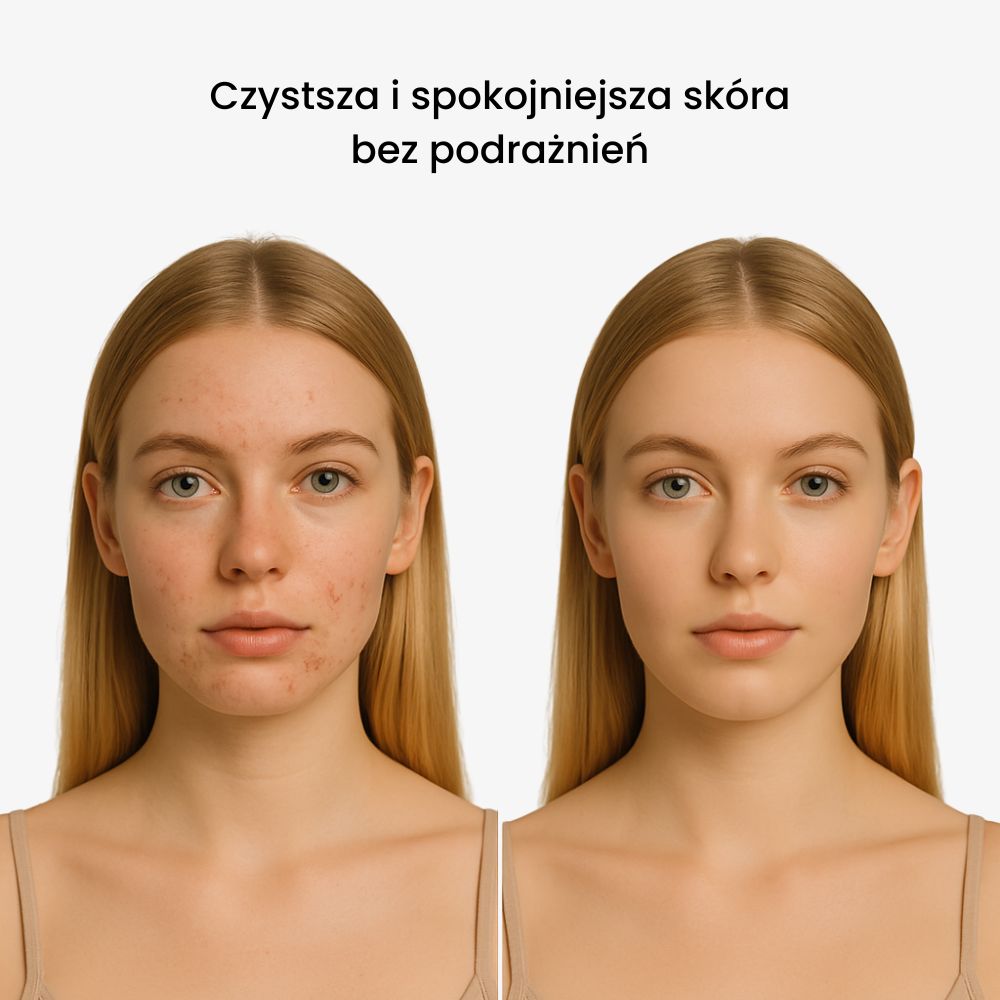 DermaLabs – Słuchawka prysznicowa dla zdrowszych włosów i skóry